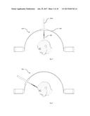 A DEVICE AND METHOD FOR FOLLICULAR UNIT TRANSPLANTATION diagram and image