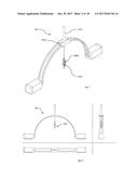 A DEVICE AND METHOD FOR FOLLICULAR UNIT TRANSPLANTATION diagram and image