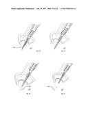 A DEVICE AND METHOD FOR FOLLICULAR UNIT TRANSPLANTATION diagram and image