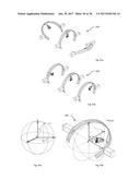 A DEVICE AND METHOD FOR FOLLICULAR UNIT TRANSPLANTATION diagram and image