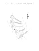 METHOD AND APPARATUS FOR THE TREATMENT OF SCOLIOSIS diagram and image