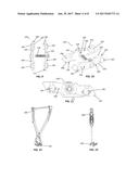 Spinous Process Plate Fixation Assembly diagram and image