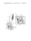 Spinous Process Plate Fixation Assembly diagram and image