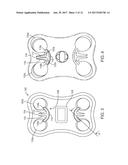 BONE FIXATION SYSTEMS AND METHODS diagram and image