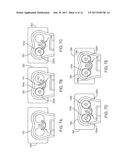 BONE FIXATION SYSTEMS AND METHODS diagram and image