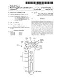 WRIST PLATE AND DRILL GUIDE diagram and image