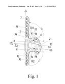 General anatomic self-locking plate for medial acetabulum and auxiliary     apparatus thereof diagram and image