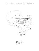 General anatomic self-locking plate for medial acetabulum and auxiliary     apparatus thereof diagram and image