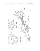 MECHANISED BONE CEMENT DELIVERY SYSTEM WITH A VALVE THAT CLOSES TO STOP     THE FLOW OF PRESSURIZED CEMENT diagram and image