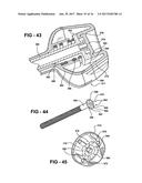 MECHANISED BONE CEMENT DELIVERY SYSTEM WITH A VALVE THAT CLOSES TO STOP     THE FLOW OF PRESSURIZED CEMENT diagram and image