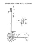 MECHANISED BONE CEMENT DELIVERY SYSTEM WITH A VALVE THAT CLOSES TO STOP     THE FLOW OF PRESSURIZED CEMENT diagram and image