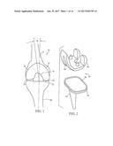 KNEE IMPLANT METHODS AND SYSTEMS diagram and image