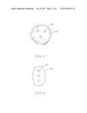 KNEE IMPLANT METHODS AND SYSTEMS diagram and image