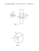 KNEE IMPLANT METHODS AND SYSTEMS diagram and image