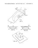 APPARATUS AND METHOD FOR DEPLOYING A SURGICAL PREPARATION diagram and image