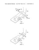 APPARATUS AND METHOD FOR DEPLOYING A SURGICAL PREPARATION diagram and image