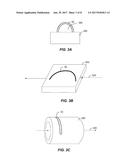 ION IMPLANTATION MODIFICATION OF ARCHWIRES diagram and image