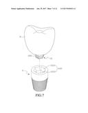 DENTAL IMPLANT ASSEMBLY AND ABUTMENT THEREOF diagram and image