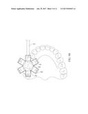 NOVEL DENTAL SCANNER DEVICE AND SYSTEM AND METHODS OF USE diagram and image