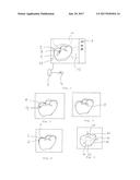 METHOD FOR THE COMPUTER-AIDED EDITING OF A DIGITAL 3D MODEL diagram and image