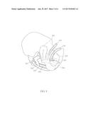 IMPLANTS FOR PELVIC ORGAN PROLAPSE SUPPORT diagram and image