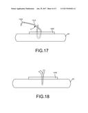 DELIVERY TOOLS FOR MEDICAL IMPLANTS AND METHODS OF USING THE SAME diagram and image