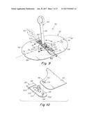 DEPLOYMENT DEVICE FOR A SOFT TISSUE REPAIR PROSTHESIS diagram and image