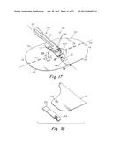 DEPLOYMENT DEVICE FOR A SOFT TISSUE REPAIR PROSTHESIS diagram and image