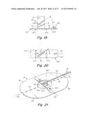 DEPLOYMENT DEVICE FOR A SOFT TISSUE REPAIR PROSTHESIS diagram and image