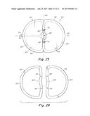 DEPLOYMENT DEVICE FOR A SOFT TISSUE REPAIR PROSTHESIS diagram and image