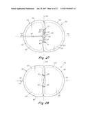 DEPLOYMENT DEVICE FOR A SOFT TISSUE REPAIR PROSTHESIS diagram and image