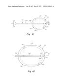 DEPLOYMENT DEVICE FOR A SOFT TISSUE REPAIR PROSTHESIS diagram and image