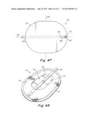 DEPLOYMENT DEVICE FOR A SOFT TISSUE REPAIR PROSTHESIS diagram and image