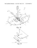 DEPLOYMENT DEVICE FOR A SOFT TISSUE REPAIR PROSTHESIS diagram and image