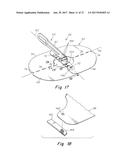 DEPLOYMENT DEVICE FOR A SOFT TISSUE REPAIR PROSTHESIS diagram and image