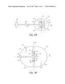 DEPLOYMENT DEVICE FOR A SOFT TISSUE REPAIR PROSTHESIS diagram and image