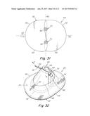 DEPLOYMENT DEVICE FOR A SOFT TISSUE REPAIR PROSTHESIS diagram and image