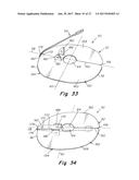 DEPLOYMENT DEVICE FOR A SOFT TISSUE REPAIR PROSTHESIS diagram and image