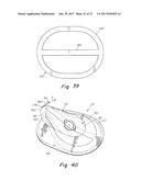 DEPLOYMENT DEVICE FOR A SOFT TISSUE REPAIR PROSTHESIS diagram and image