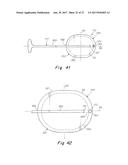 DEPLOYMENT DEVICE FOR A SOFT TISSUE REPAIR PROSTHESIS diagram and image