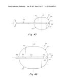 DEPLOYMENT DEVICE FOR A SOFT TISSUE REPAIR PROSTHESIS diagram and image