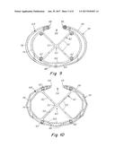 PROSTHESIS FOR REPAIRING A HERNIA DEFECT diagram and image