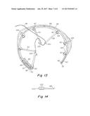 PROSTHESIS FOR REPAIRING A HERNIA DEFECT diagram and image