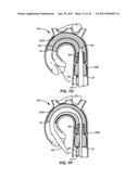 MULTI-ACCESS INTRAPROCEDURAL EMBOLIC PROTECTION DEVICE diagram and image