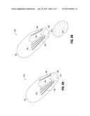 PROSTHETIC IMPLANT DELIVERY DEVICE AND METHOD diagram and image