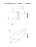 PROSTHETIC IMPLANT DELIVERY DEVICE AND METHOD diagram and image