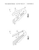 PROSTHETIC IMPLANT DELIVERY DEVICE AND METHOD diagram and image