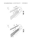 PROSTHETIC IMPLANT DELIVERY DEVICE AND METHOD diagram and image