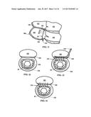 Device and Method for Temporary or Permanent Suspension of an Implantable     Scaffolding Containing an Orifice for Placement of a Prosthetic or     Bio-Prosthetic Valve diagram and image