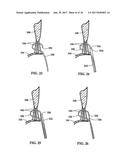 Device and Method for Temporary or Permanent Suspension of an Implantable     Scaffolding Containing an Orifice for Placement of a Prosthetic or     Bio-Prosthetic Valve diagram and image